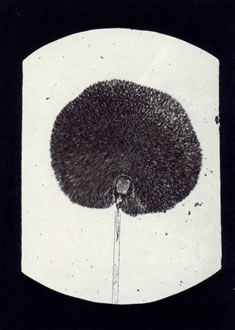 Robert Koch (Umkreis): „M. Mucedo 40x. Ein großes Sporangium, etwas gedrückt, so daß die Columella sichtbar ist (Köpfchenschimmel)“, o.J.
