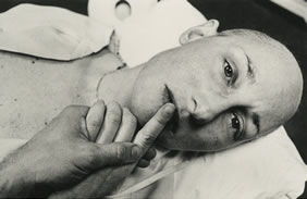 Eugene Richards: „Dorothea, after Chemotherapy“, 1979